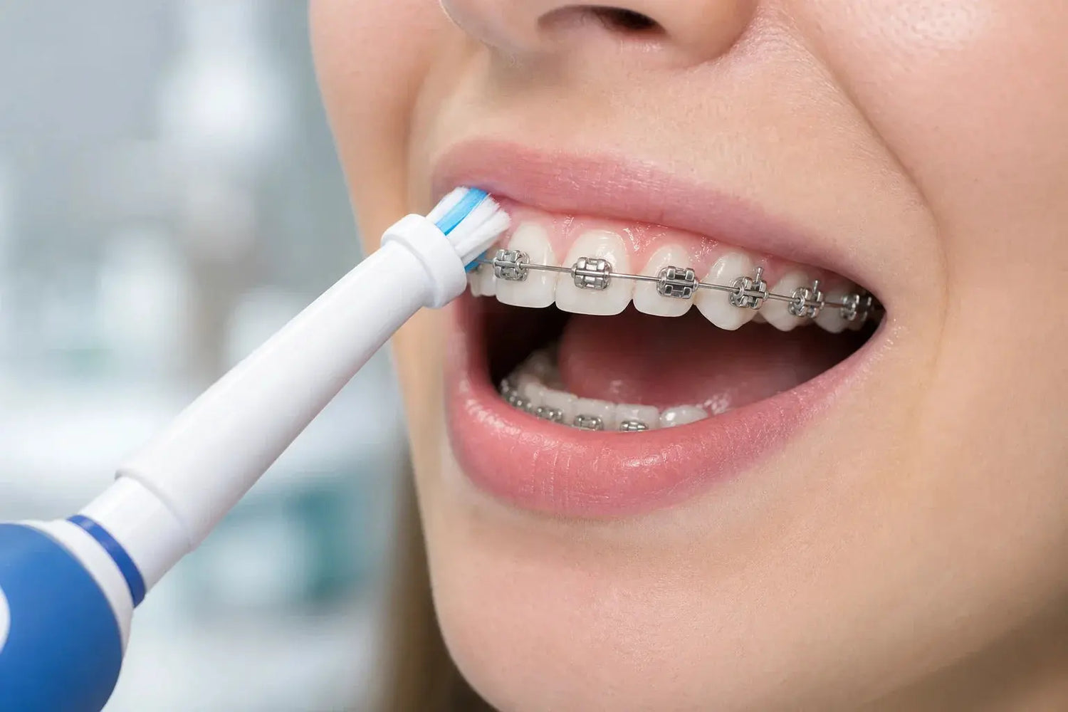 Can You Use an Electric Toothbrush With Braces?