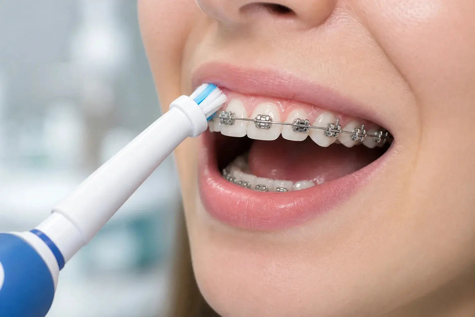 Can You Use an Electric Toothbrush With Braces?