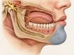 Anatomical cutaway of the lower face showing the trigeminal nerve branches that supply sensation to the jaw, tongue, lower lip, and chin, with a subtle blue-grey wash indicating numbness in the lower lip and chin.